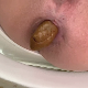 This a nice, close-up bowlcam view of a woman taking a firm, but long shit into a toilet. Presented in 720P HD. About 5 minutes.